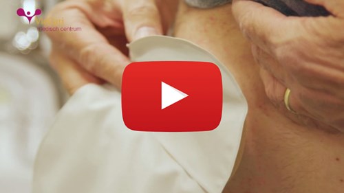 Voorlichtingsvideo over stomazorg om uw stoma zelf te verzorgen