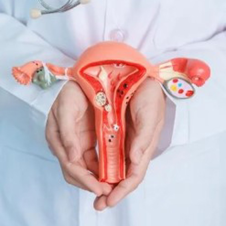 Baarmoeder, eierstokken Baarmoeder, eierstokken