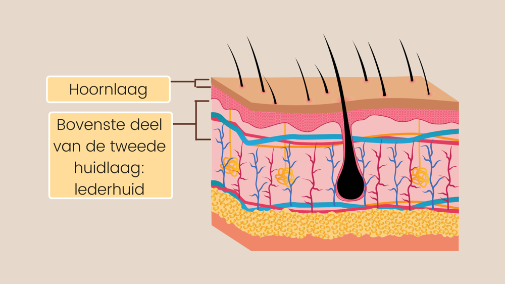 Huidbehandeling met chemische peeling