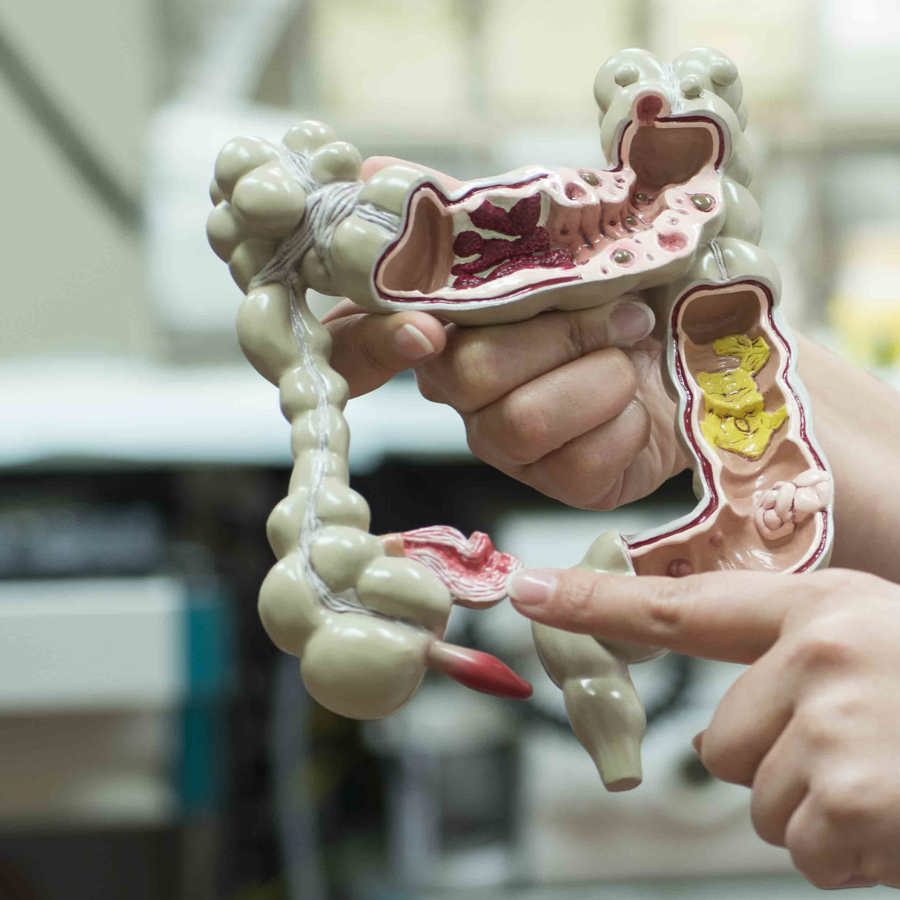 anatomiemodel darmen anatomiemodel darmen