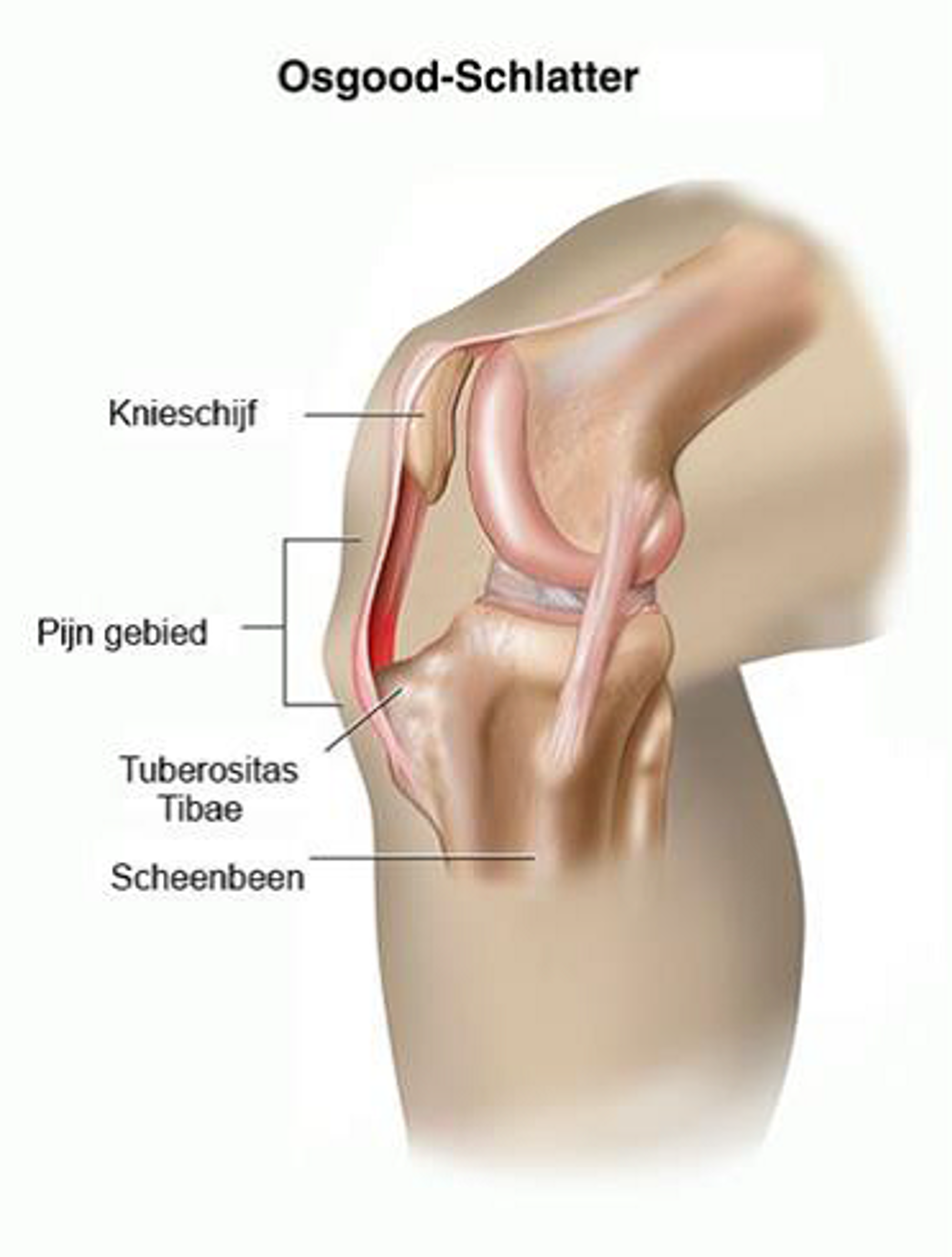 tekening van een knie