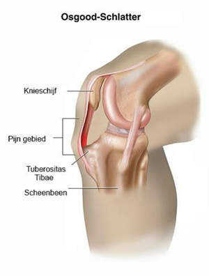 tekening van een knie
