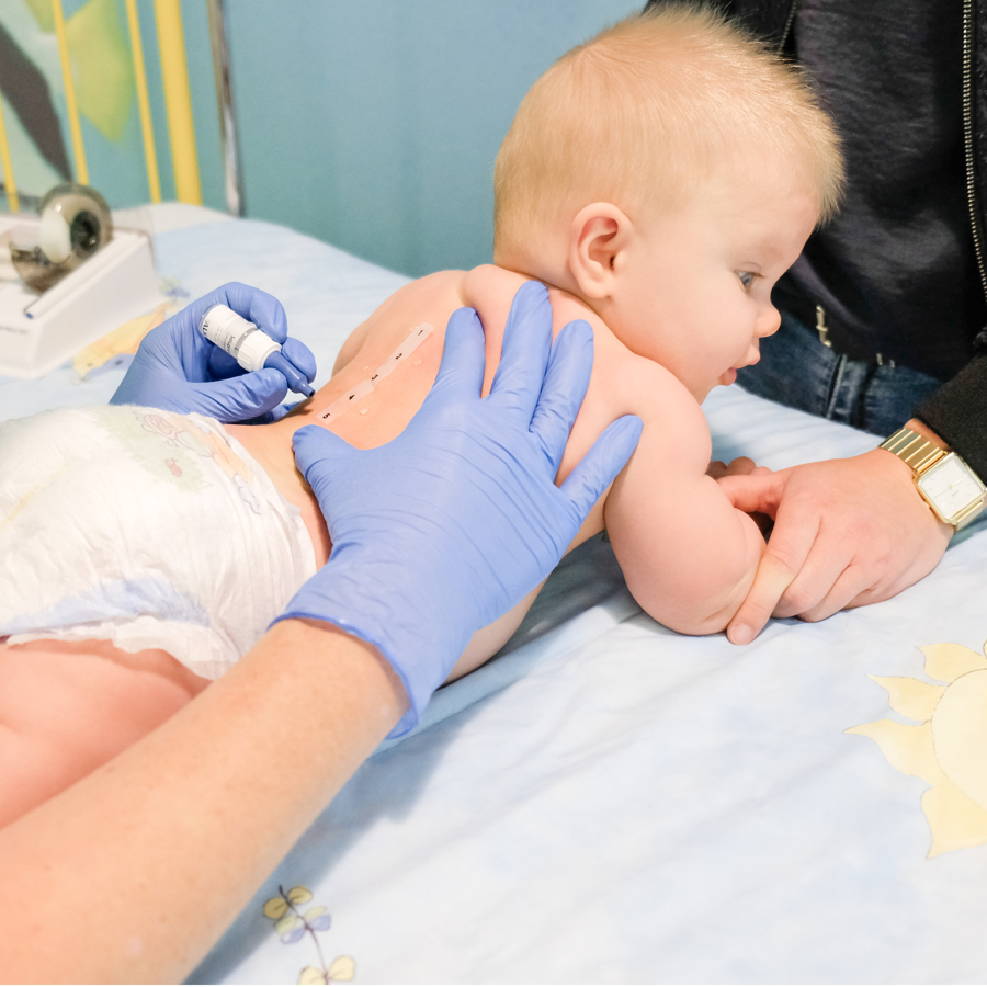 Op deze afbeelding is een baby te zien die een huidpriktest krijgt Op deze afbeelding is een baby te zien die een huidpriktest krijgt