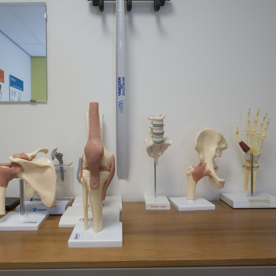 Modellen van een schouder, knie, wervel, heup en hand Modellen van een schouder, knie, wervel, heup en hand